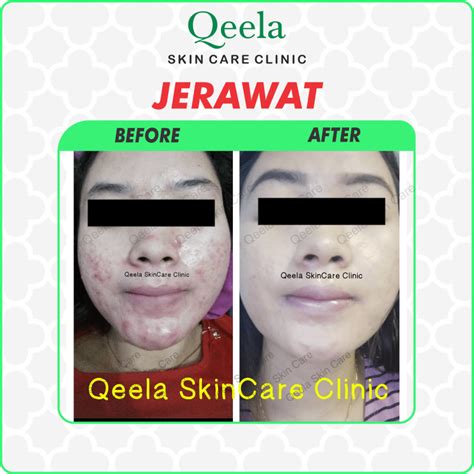 7 Daftar Harga Perawatan di Nabila Skin Care: Rahasia Glowing Mulai 50 Ribuan! 7 Daftar Harga Perawatan di Nabila Skin Care: Rahasia Glowing Mulai 50 Ribuan!