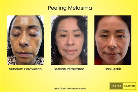 7 Daftar Harga Perawatan di Nabila Skin Care: Rahasia Glowing Mulai 50 Ribuan! 7 Daftar Harga Perawatan di Nabila Skin Care: Rahasia Glowing Mulai 50 Ribuan!