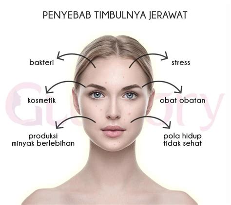 7 Rahasia Kulit Mulus Bebas Kilap and Jerawat: Panduan Lengkap untuk Kulit Sensitif Berminyak!