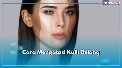 7 Skincare Ampuh Atasi Wajah Belang dalam 2 Minggu!