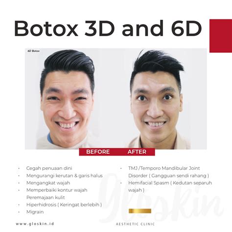 5 Rahasia Harga Treatment di Gloskin: Mulai dari 99 Ribu! 5 Rahasia Harga Treatment di Gloskin: Mulai dari 99 Ribu!