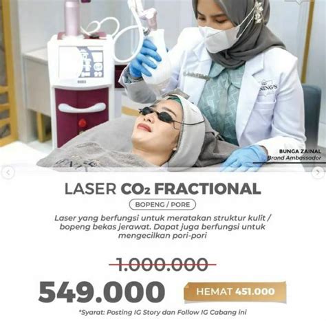 7 Fakta Mengejutkan Harga Laser CO2 di Larissa: Nomor 5 Bikin Dompet Nangis!