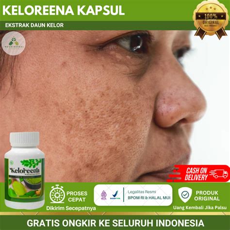 7 Masker Penghilang Bintik Bintik di Wajah yang Ampuh dan Alami untuk Kulit Mulus 7 Masker Penghilang Bintik Bintik di Wajah yang Ampuh dan Alami untuk Kulit Mulus