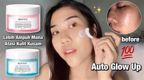 10 Moisturizer Terbaik untuk Kulit Kusam: Bye Wajah Kucel, Hello Glowing! 10 Moisturizer Terbaik untuk Kulit Kusam: Bye Wajah Kucel, Hello Glowing!