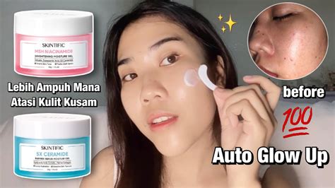 10 Moisturizer Terbaik untuk Kulit Kusam: Bye Wajah Kucel, Hello Glowing! 10 Moisturizer Terbaik untuk Kulit Kusam: Bye Wajah Kucel, Hello Glowing!