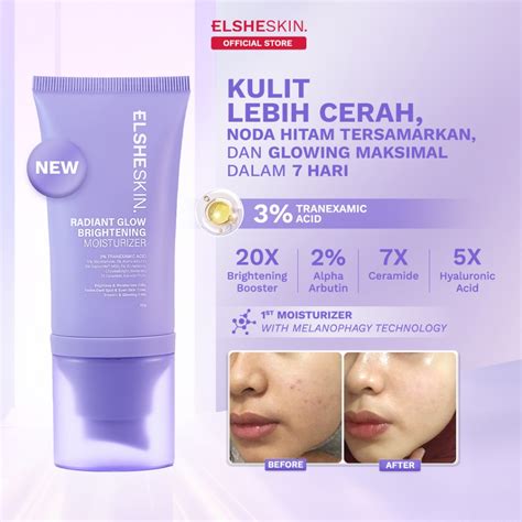 5 Kesalahan Pakai Moisturizer yang Bikin Kulit Dehidrasi! 5 Kesalahan Pakai Moisturizer yang Bikin Kulit Dehidrasi!