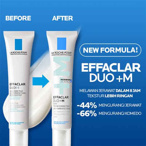 5 Moisturizer Terbaik untuk Kulit Remaja: Bye-Bye Jerawat! 5 Moisturizer Terbaik untuk Kulit Remaja: Bye-Bye Jerawat!