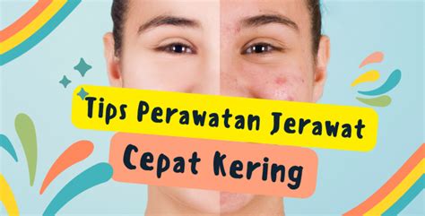 5 Rahasia Glowing Bebas Jerawat: Perawatan Kulit dari Dalam yang Wajib Kamu Tahu! 5 Rahasia Glowing Bebas Jerawat: Perawatan Kulit dari Dalam yang Wajib Kamu Tahu!