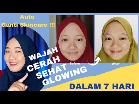 5 Rahasia Perawatan Korea: Glowing dalam 7 Hari!