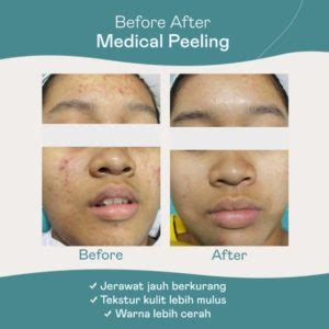 5 TREATMENT Skincare NMW Terhits Di Bawah Rp500 Ribu! 5 TREATMENT Skincare NMW Terhits Di Bawah Rp500 Ribu!