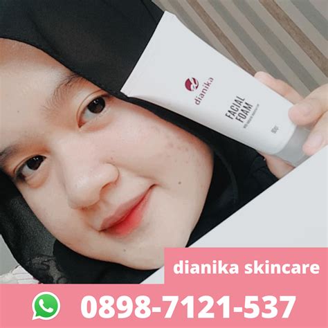 5 TREATMENT Skincare NMW Terhits Di Bawah Rp500 Ribu! 5 TREATMENT Skincare NMW Terhits Di Bawah Rp500 Ribu!