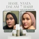 7 Hari Kulit Cerah Maksimal? Bongkar Rahasia Paket Scarlett Badan!