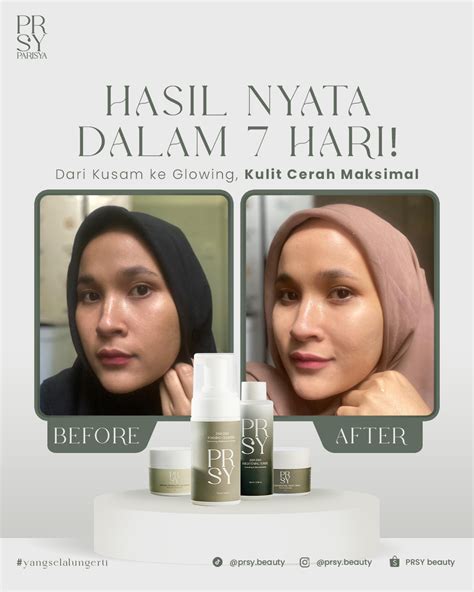 7 Hari Kulit Cerah Maksimal? Bongkar Rahasia Paket Scarlett Badan! 7 Hari Kulit Cerah Maksimal? Bongkar Rahasia Paket Scarlett Badan!