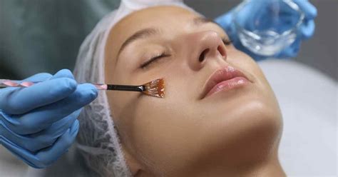 7 Peeling Wajah Terbaik untuk Kulit Glowing Bebas Kusam! 7 Peeling Wajah Terbaik untuk Kulit Glowing Bebas Kusam!