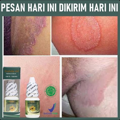7 Rahasia Area Selangkangan Bebas Gelap and Lembap, Bye-Bye Minder! 7 Rahasia Area Selangkangan Bebas Gelap and Lembap, Bye-Bye Minder!