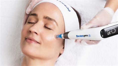 7 Rahasia Efektif Perawatan Dermapen untuk Kulit Glowing! 7 Rahasia Efektif Perawatan Dermapen untuk Kulit Glowing!
