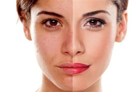 7 Rahasia Wajah Glowing Bebas Kusam, Bye-Bye Kulit Kusam!